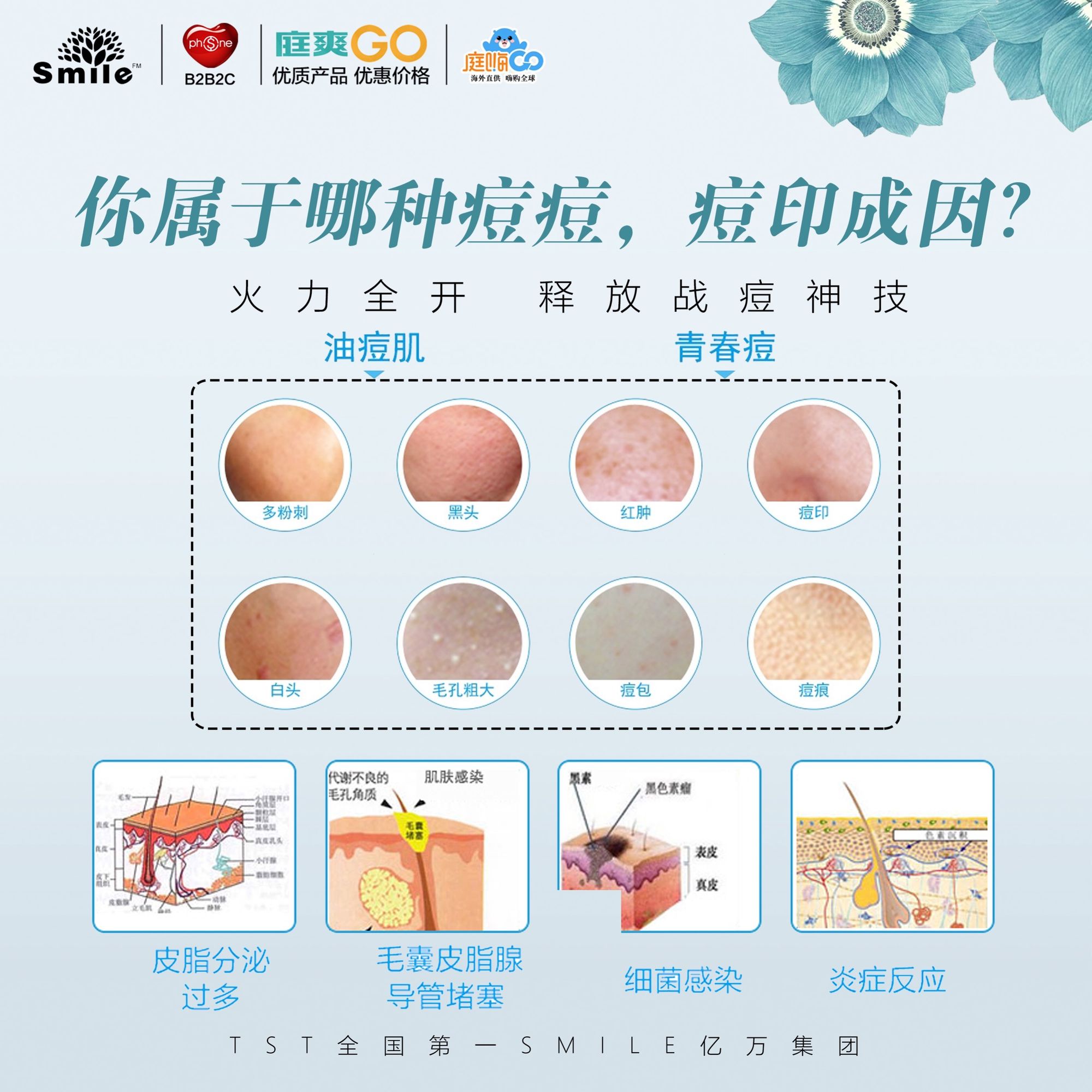 脸上有痤疮要补锌多久(痤疮补锌有用吗)-硒宝网