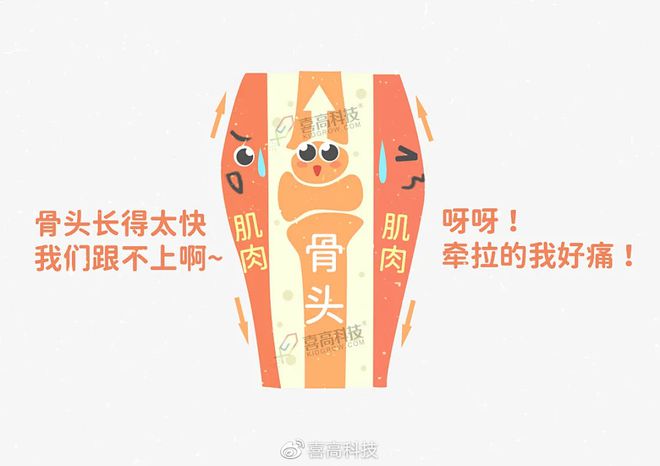 生长痛需要补钙吗（补钙可以缓解生长痛吗）-硒宝网