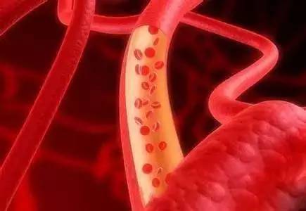 红豆补铁吗（红豆补铁效果怎么样）-硒宝网