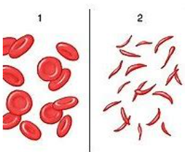 什么人需要补铁(补铁需要补钙吗)-硒宝网