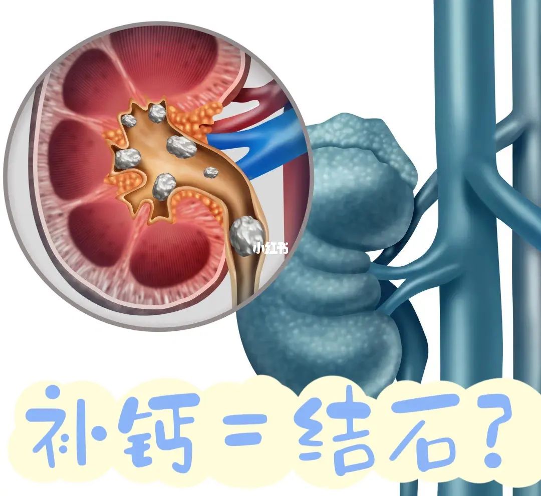 补钙过量会有什么症状(过量补钙会导致什么)-硒宝网