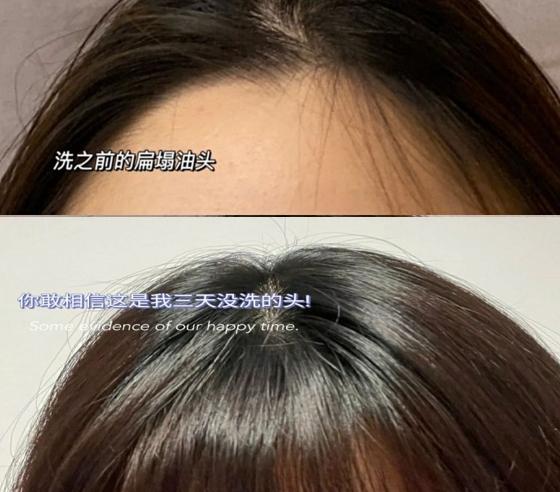 孕妇补锌什么牌子好(孕妇吃什么牌子的锌)-硒宝网