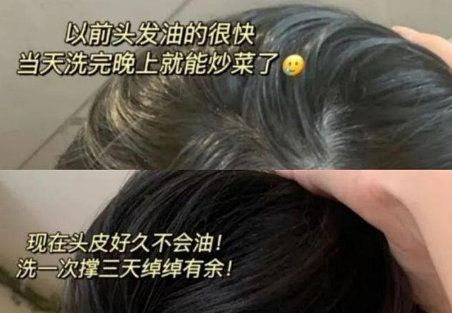 孕妇补锌什么牌子好(孕妇吃什么牌子的锌)-硒宝网