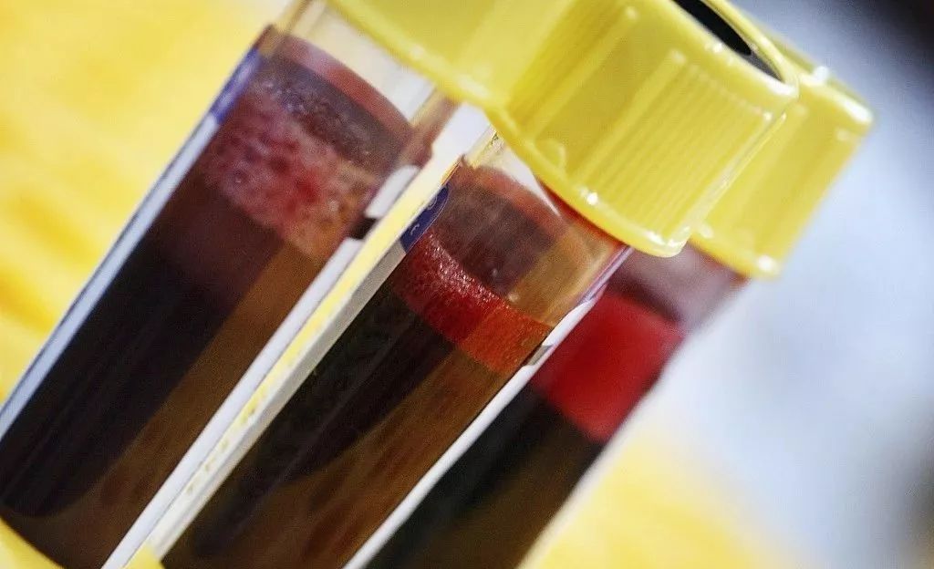 微量元素检查结果怎么看（微量元素检查结果看什么）-硒宝网