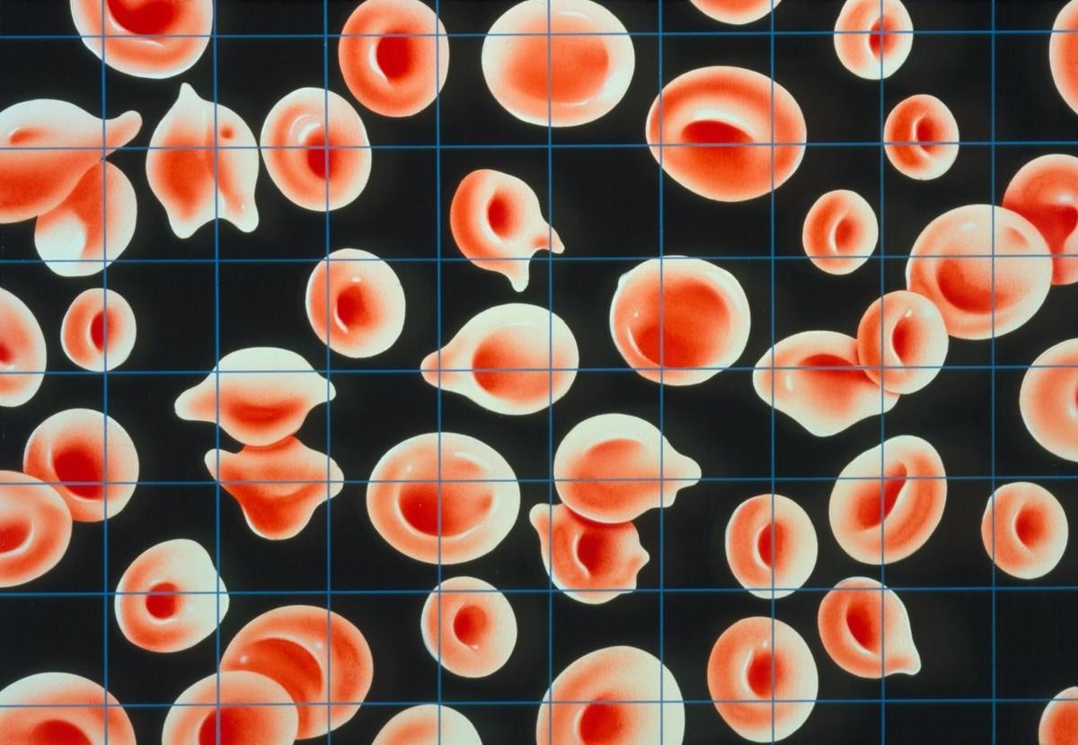 孕妇几个月开始补铁(孕妇开始补铁月经不来了)-硒宝网