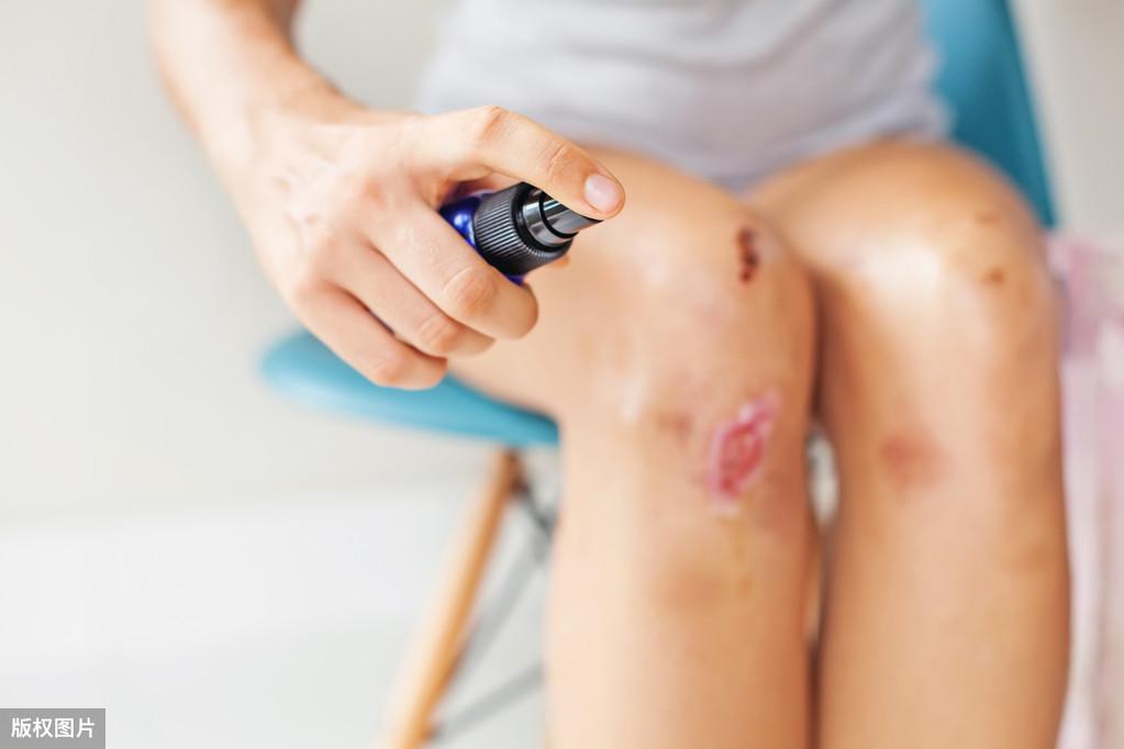 补锌吃什么药效果最好（效果药吃好补锌吗）-硒宝网