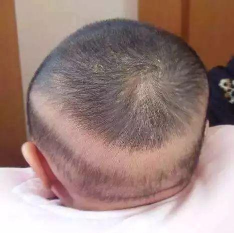 补钙多久要停一停（停止吃钙片）-硒宝网