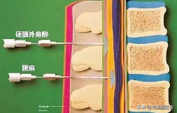 锌硒宝高血压（有高血压能吃锌和硒吗）-硒宝网