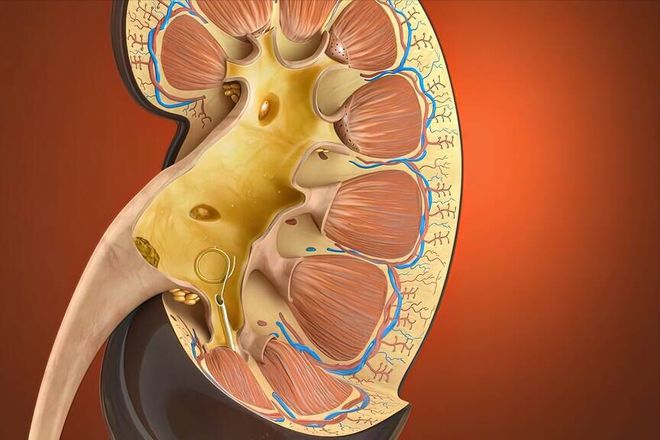 有肾结石可以补钙吗(肾结石补钙可以吃维生素k2吗)-硒宝网