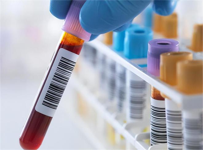 有肾结石可以补钙吗(肾结石补钙可以吃维生素k2吗)-硒宝网