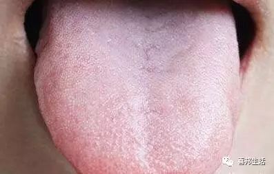 锌硒宝 中毒（锌硒宝过量会中毒吗）-硒宝网