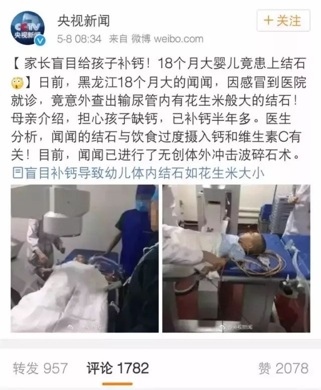 宝宝几个月补钙(补钙宝宝)-硒宝网