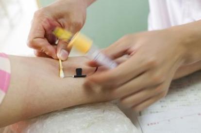 查微量元素要空腹吗（微量元素检查空腹）-硒宝网