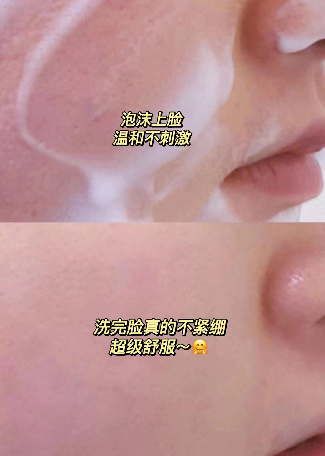 锌硒宝治痘痘(锌能治痘痘吗)-硒宝网