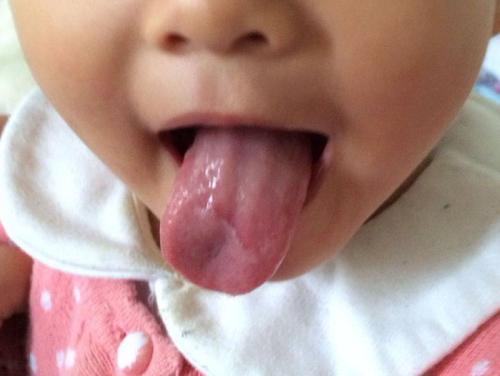 锌硒宝的危害(锌硒宝主要成分)-硒宝网