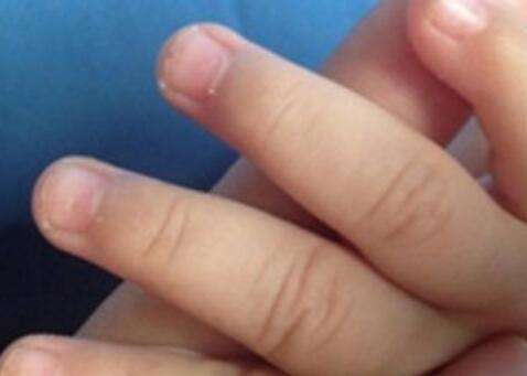 锌硒宝的危害(锌硒宝主要成分)-硒宝网