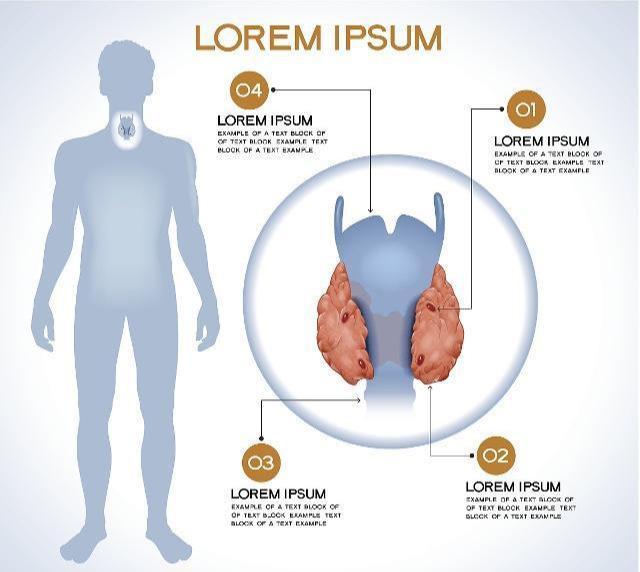 甲减需要补碘吗（需要甲减补碘吃什么药）-硒宝网