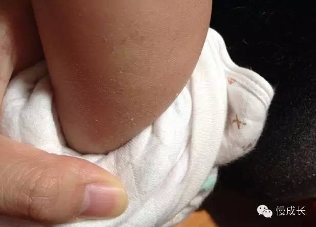 室内晒太阳可以补钙吗(晒室内补钙太阳可以吗)-硒宝网