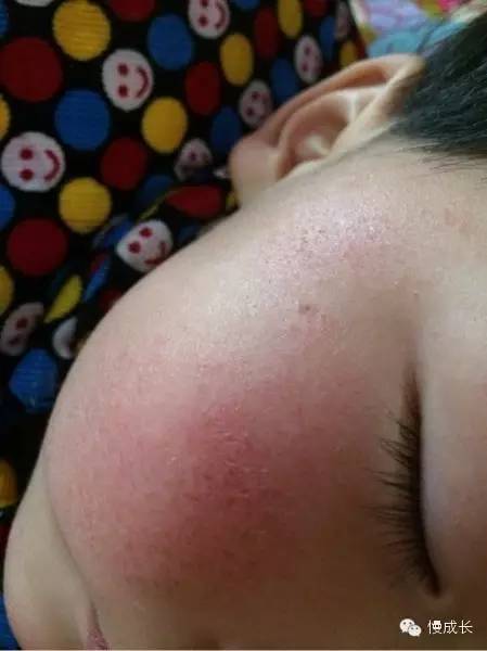 室内晒太阳可以补钙吗(晒室内补钙太阳可以吗)-硒宝网