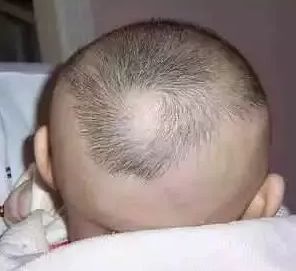 一岁多宝宝补钙哪种好（宝宝补钙有助于长高吗）-硒宝网