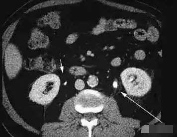 一岁多宝宝补钙哪种好（宝宝补钙有助于长高吗）-硒宝网
