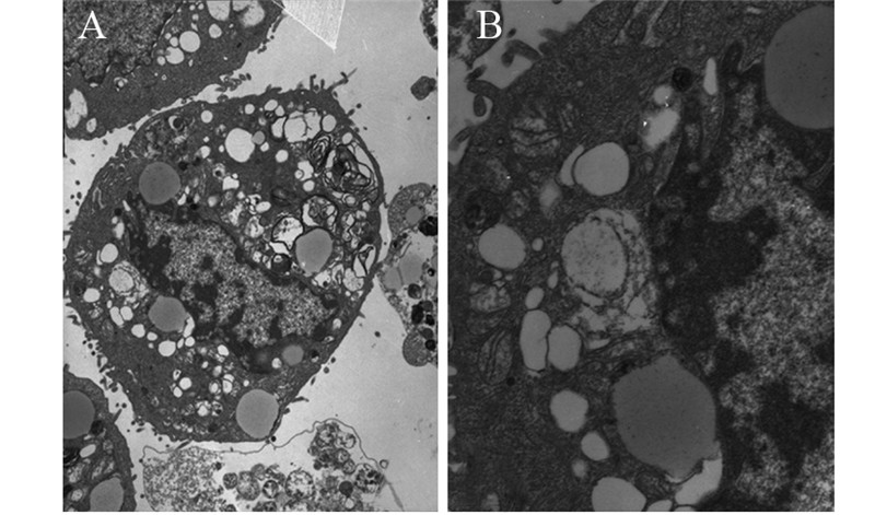 锌硒宝碘蛋白(蛋白锌硒和锌硒宝的区别)-硒宝网