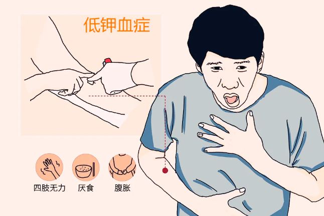 补钠浓度(补钠的浓度一般不超过多少)-硒宝网