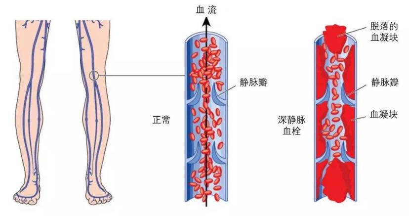 补钠浓度(补钠的浓度一般不超过多少)-硒宝网