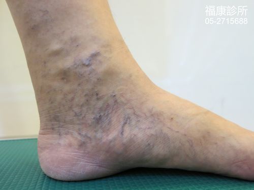 补钠浓度(补钠的浓度一般不超过多少)-硒宝网