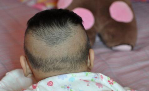 锌硒宝是激素（锌硒宝对人体的危害）-硒宝网