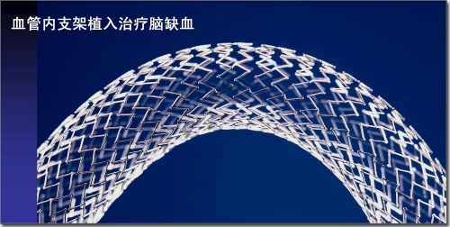 锌硒宝治疗?。ㄐ课τ行Ч穑?硒宝网