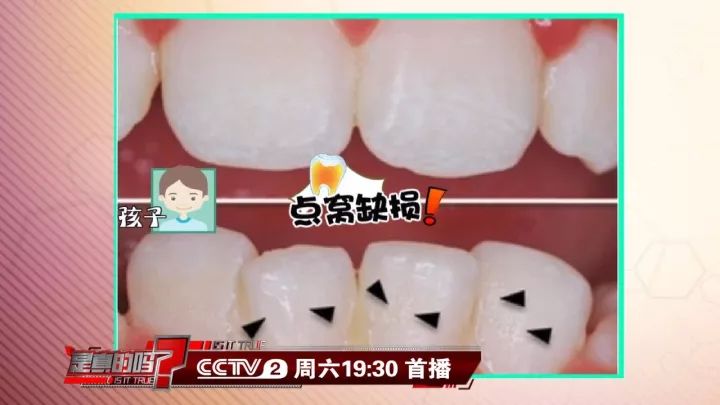 补钙能坚固牙齿吗(坚固牙齿吃什么钙片好)-硒宝网