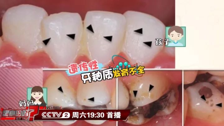 补钙能坚固牙齿吗(坚固牙齿吃什么钙片好)-硒宝网