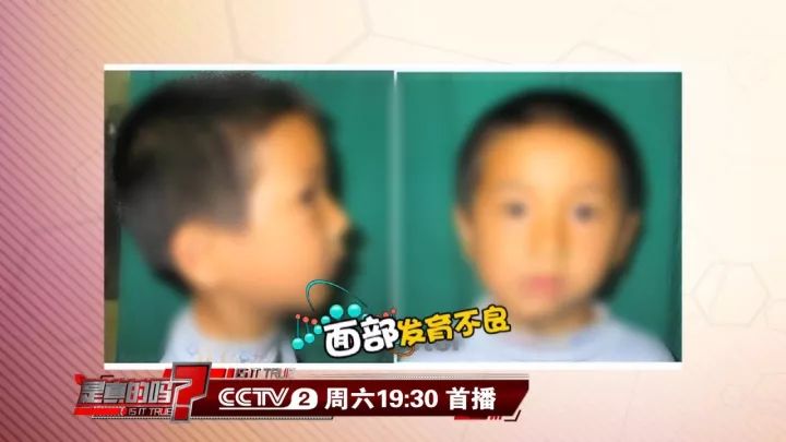 补钙能坚固牙齿吗(坚固牙齿吃什么钙片好)-硒宝网