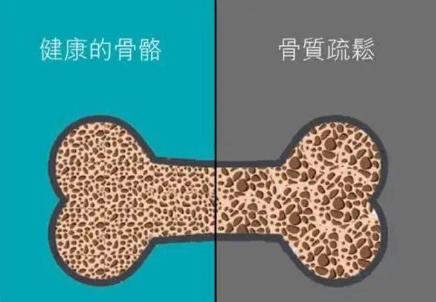 正确补钙（补钙正确的打开方式）-硒宝网