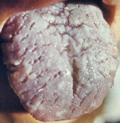 锌硒宝的规格（锌硒宝含量表）-硒宝网