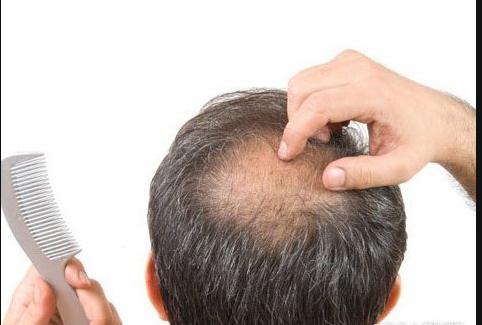 吃锌硒宝脱发(脱发补硒和锌)-硒宝网