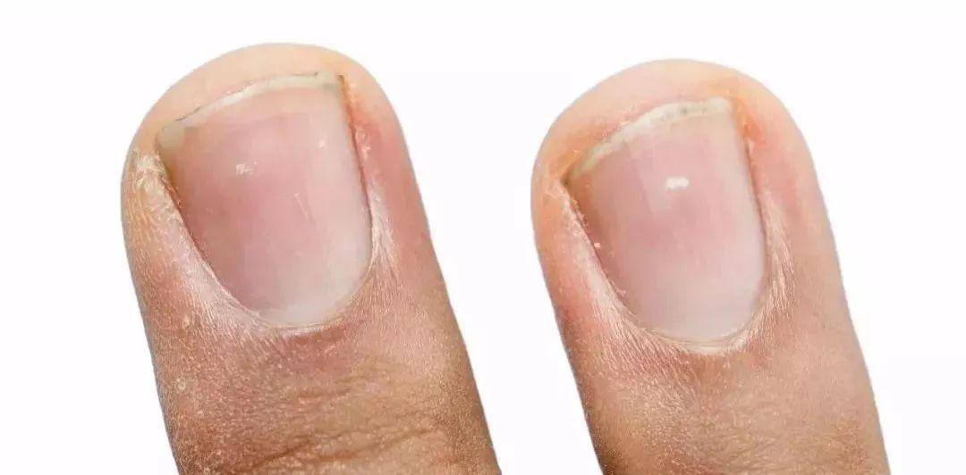 锌硒宝片如何(锌硒宝片的吃法)-硒宝网