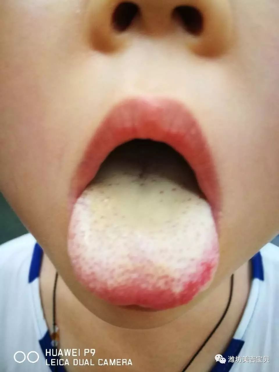 锌硒宝怎么用（锌硒宝到底有没有用）-硒宝网