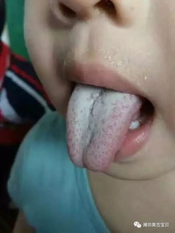 锌硒宝怎么用（锌硒宝到底有没有用）-硒宝网