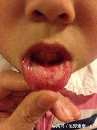 锌硒宝孩子量(儿童服用锌硒宝的用法及用量)-硒宝网