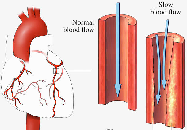 锌硒宝对心脏(锌硒宝有什么副作用吗)-硒宝网