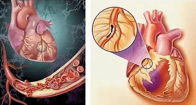 锌硒宝对心脏(锌硒宝有什么副作用吗)-硒宝网