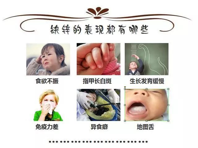 锌硒宝和钙片(锌硒宝好不好)-硒宝网