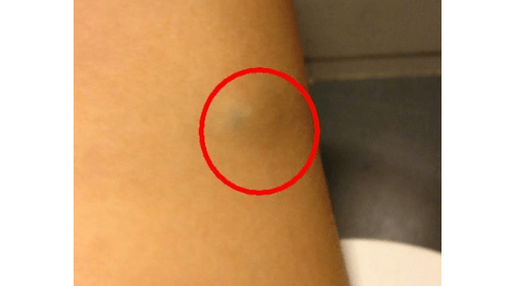 锌硒宝会勃起(锌硒宝对性功能有帮助吗)-硒宝网