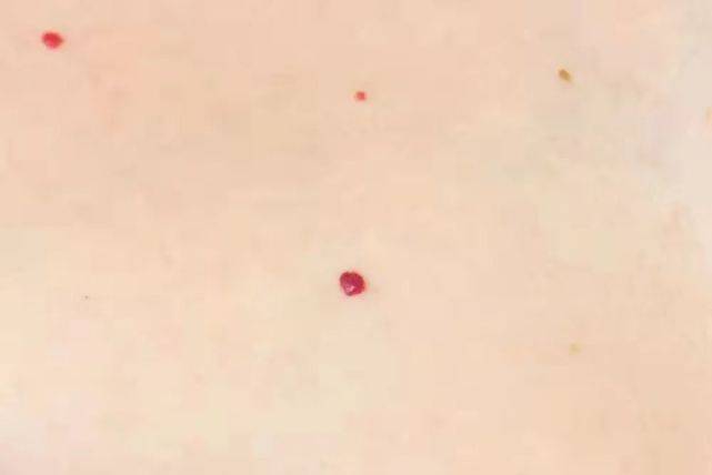 锌硒宝会勃起(锌硒宝对性功能有帮助吗)-硒宝网