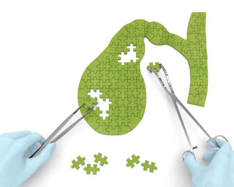 锌硒宝胆结石（锌硒宝治什么）-硒宝网