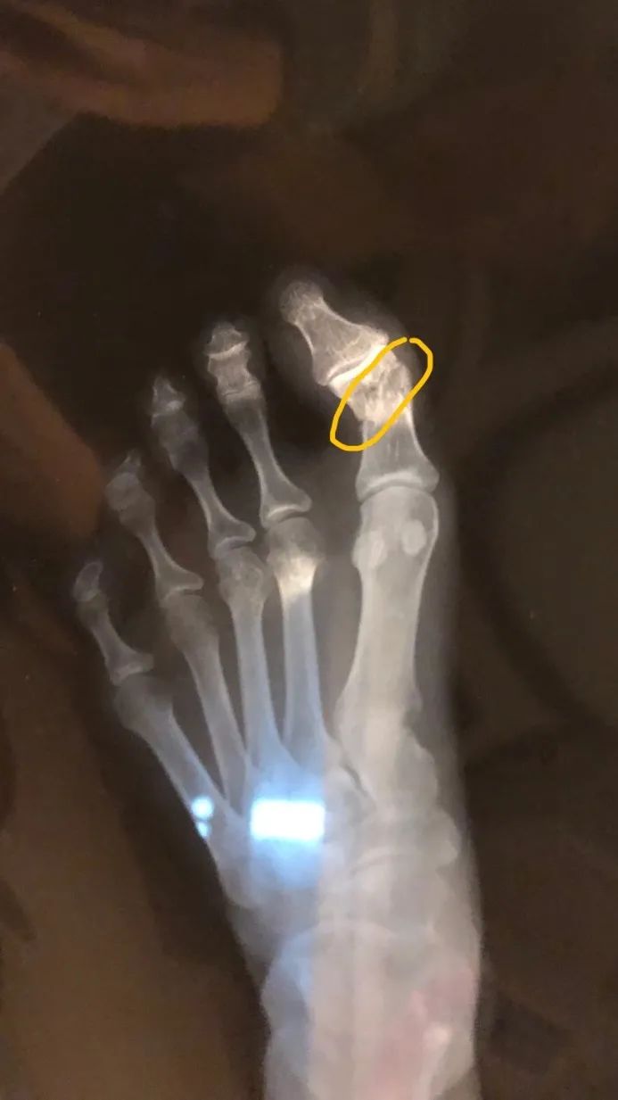 锌硒宝和玛咖（锌硒宝是不是涉及虚假宣传）-硒宝网