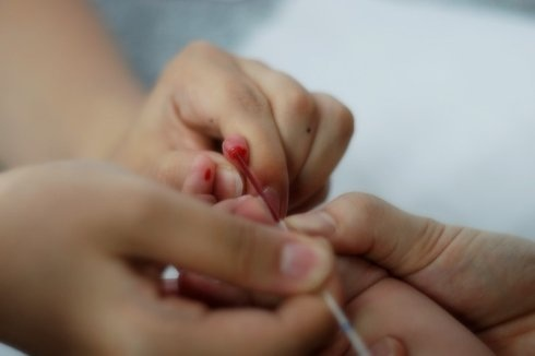 检查微量元素多久出结果（微量元素检查结果出来要多久）-硒宝网