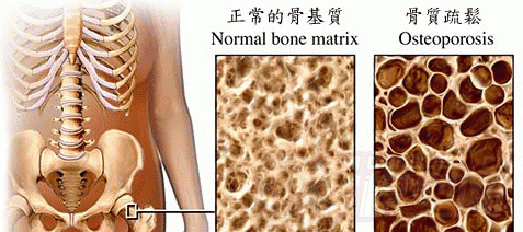 如何给牙齿补钙(牙齿补钙吃什么钙片好)-硒宝网